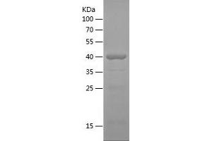 Western Blotting (WB) image for Catenin (Cadherin-Associated Protein), alpha 2 (CTNNA2) (AA 493-858) protein (His tag) (ABIN7122178)