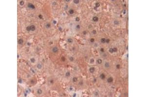 IHC-P analysis of Human Tissue, with DAB staining. (MT1E anticorps  (AA 1-61))