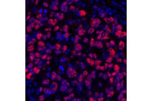 Immunofluorescence (IF) image for anti-SRY (Sex Determining Region Y)-Box 10 (SOX10) (AA 416-466) antibody (ABIN7455186) (SOX10 anticorps  (AA 416-466))