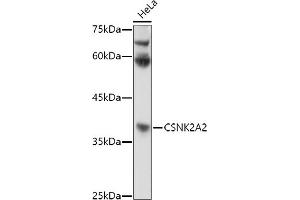 Western blot analysis of extracts of HeLa cells, using CSNK2 antibody (ABIN3022252, ABIN3022253, ABIN3022254 and ABIN6218695) at 1:1000 dilution. (CSNK2A2 anticorps  (AA 1-350))
