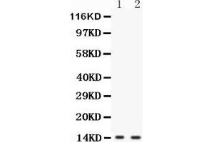 Anti-FABP6 antibody, Western blottingAll lanes: Anti FABP6  at 0. (FABP6 anticorps  (N-Term))