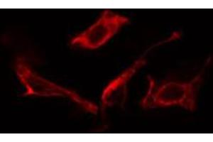 ABIN6266758 staining NIH-3T3 cells by IF/ICC.