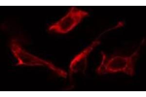 ABIN6266758 staining NIH-3T3 cells by IF/ICC. (MAN1B1 anticorps  (Internal Region))