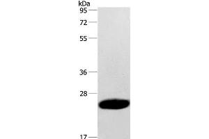 Western Blot analysis of Human fetal muscle tissue using CAV3 Polyclonal Antibody at dilution of 1:500 (Caveolin 3 anticorps)
