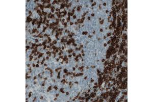 Immunohistochemical staining (Formalin-fixed paraffin-embedded sections) of human tonsil with CD3E monoclonal antibody, clone CL1497  shows strong positivity in a subset of lymphoid cells. (CD3 epsilon anticorps  (AA 25-126))