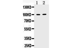 Western blot analysis of TACC1 expression in mouse testis extract ( Lane 1) and U87 whole cell lysates ( Lane 2).
