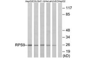 Western blot analysis of extracts from HepG2/COLO/HT-29/HeLa/HuvEc cells, using RPS9 Antibody. (RPS9 anticorps  (AA 31-80))
