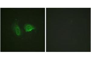 Immunofluorescence analysis of HeLa cells, using Calcium Sensing Receptor (Phospho-Thr888) Antibody. (CASR anticorps  (pThr888))