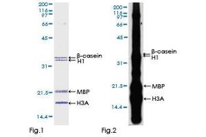Kinase Activity Assay (KAA) image for Dual-Specificity tyrosine-(Y)-phosphorylation Regulated Kinase 3 (DYRK3) (AA 1-568) protein (GST tag) (ABIN1352210)