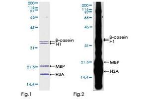 Kinase Activity Assay (KAA) image for Dual-Specificity tyrosine-(Y)-phosphorylation Regulated Kinase 3 (DYRK3) (AA 1-568) protein (GST tag) (ABIN1352210) (DYRK3 Protein (AA 1-568) (GST tag))