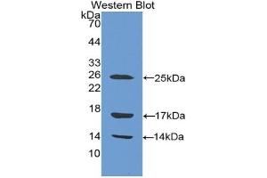Detection of Recombinant CAMP, Human using Polyclonal Antibody to Cathelicidin Antimicrobial Peptide (CAMP) (Cathelicidin anticorps  (AA 31-170))