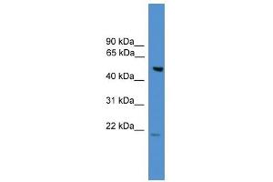 ALS2CR12 antibody used at 0. (ALS2CR12 anticorps  (N-Term))
