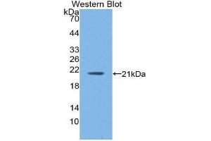 Western Blotting (WB) image for anti-Hemoglobin, alpha 1 (HBA1) (AA 1-142) antibody (ABIN1859123) (HBA1 anticorps  (AA 1-142))
