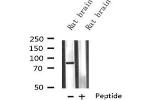 Western blot analysis on Rat brain lysate using CPT1C-specific antibody