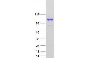 Validation with Western Blot