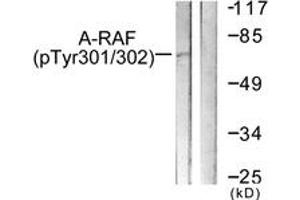 Western blot analysis of extracts from HeLa cells treated with PMA 125ng/ml 30', using A-RAF (Phospho-Tyr302) Antibody. (ARAF anticorps  (pTyr302))
