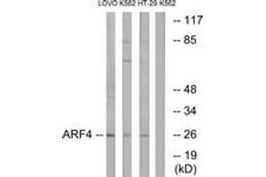 Western blot analysis of extracts from LOVO/K562/HT-29 cells, using ARF4 Antibody. (ARF4 anticorps  (AA 71-120))