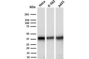 Western Blot Analysis of Human HeLa, K-562 and A431 cell lysates using AKR1C2 Mouse Monoclonal Antibody (CPTC-AKR1C2-1). (AKR1C2 anticorps)