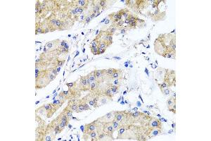 Immunohistochemistry of paraffin-embedded human gastric using PSTPIP1 antibody at dilution of 1:100 (x40 lens). (PSTPIP1 anticorps)