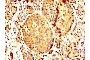 IHC image of ABIN7166420 diluted at 1:200 and staining in paraffin-embedded human pancreatic tissue performed on a Leica BondTM system.