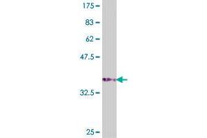 Western Blot detection against Immunogen (37.