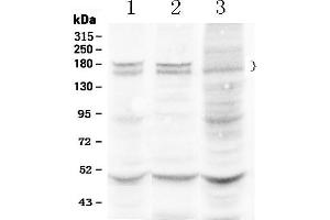 Western blot analysis of Thrombospondin using anti- Thrombospondin antibody . (Thrombospondin 1 anticorps  (AA 27-112))