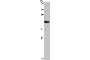 Western Blotting (WB) image for anti-Hydroxy-delta-5-Steroid Dehydrogenase, 3 beta- and Steroid delta-Isomerase 1 (HSD3B1) antibody (ABIN2430265) (HSD3B1 anticorps)