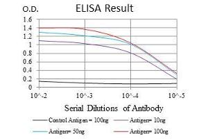anti-rho-Associated, Coiled-Coil Containing Protein Kinase 1 (ROCK1) antibody