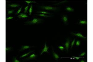 Immunofluorescence of monoclonal antibody to CALCOCO2 on HeLa cell.