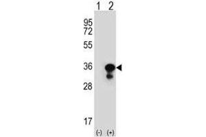Western blot analysis of PCNA antibody and 293 cell lysate (2 ug/lane) either nontransfected (Lane 1) or transiently transfected (2) with the PCNA gene. (PCNA anticorps  (AA 231-261))