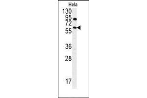 Image no. 1 for anti-anthrax Toxin Receptor 1 (ANTXR1) (AA 365-394), (Tyr382) antibody (ABIN360040) (ANTXR1 anticorps  (Tyr382))