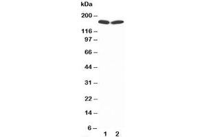 Western blot testing of nNOS antibody and Lane 1:  rat brain;  2: MCF-7;  Predicted size: 160KD;  Observed size: 160KD (NOS1 anticorps  (C-Term))