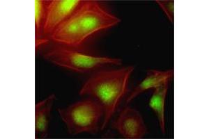 Immunofluorescence of human HeLa cells stained with Phalloidin-TRITC (Red) for Actin staining and UBE2S monoclonal antibody, clone AT2C12  (1 : 500) with Alexa 488 (Green). (UBE2S anticorps  (AA 1-222))