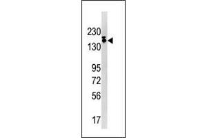 Western blot analysis of anti-SETDB1 Pab (ABIN387924 and ABIN2844389) in Ramos cell line lysate (35 μg/lane).