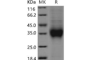 Western Blotting (WB) image for Killer Cell Lectin-Like Receptor Subfamily C, Member 1 (KLRC1) protein (His tag) (ABIN7320130)