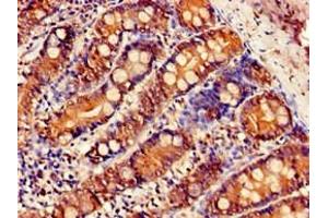 Immunohistochemistry of paraffin-embedded human small intestine tissue using ABIN7170011 at dilution of 1:100