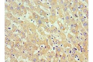 Immunohistochemistry of paraffin-embedded human liver tissue using ABIN7173812 at dilution of 1:100
