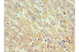 Immunohistochemistry of paraffin-embedded human liver tissue using ABIN7173812 at dilution of 1:100 (TNFSF18 anticorps  (AA 72-199))
