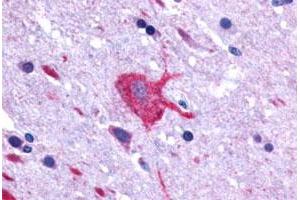 Immunohistochemical (Formalin/PFA-fixed paraffin-embedded sections) staining in human brain, neurons and glia with LGR4 polyclonal antibody . (LGR4 anticorps  (C-Term))