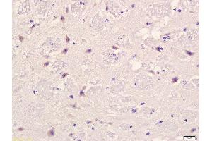 Formalin-fixed and paraffin embedded mouse brain labeled with Anti-PLAUR Polyclonal Antibody, Unconjugated  at 1:200 followed by conjugation to the secondary antibody and DAB staining. (PLAUR anticorps  (AA 201-300))
