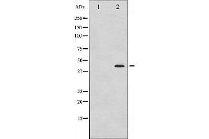 Western blot analysis of MEK1/2 phosphorylation expression in UV treated Jurkat whole cell lysates,The lane on the left is treated with the antigen-specific peptide.