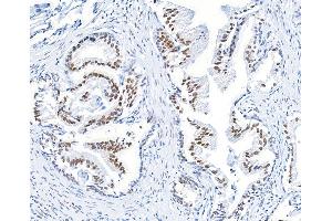Immunohistochemistry (IHC) image for anti-BMI1 Polycomb Ring Finger Oncogene (BMI1) (AA 250-300) antibody (ABIN7455106)