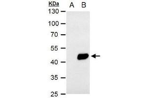 WB Image PDK1 antibody [N1C3] detects PDK1 protein by western blot analysis.
