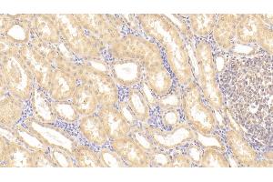 Detection of TMPRSS2 in Porcine Kidney Tissue using Polyclonal Antibody to Transmembrane Protease, Serine 2 (TMPRSS2)