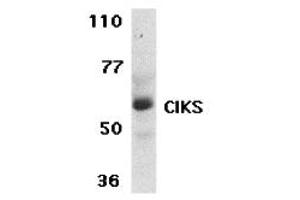 Western Blotting (WB) image for anti-TRAF3 Interacting Protein 2 (TRAF3IP2) (C-Term) antibody (ABIN1030336)