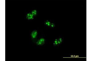 Immunofluorescence of monoclonal antibody to TCOF1 on HeLa cell.