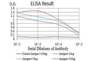 Black line: Control Antigen (100 ng),Purple line: Antigen (10 ng), Blue line: Antigen (50 ng), Red line:Antigen (100 ng)