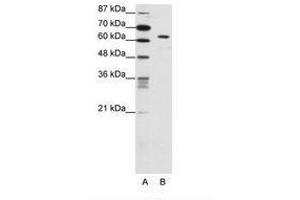 Image no. 1 for anti-SMAD, Mothers Against DPP Homolog 1 (SMAD1) (C-Term) antibody (ABIN202590) (SMAD1 anticorps  (C-Term))