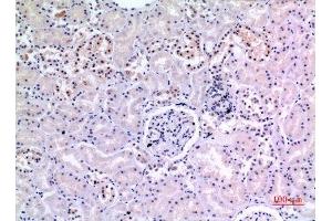 Immunohistochemistry (IHC) analysis of paraffin-embedded Human Kidney, antibody was diluted at 1:100. (XRCC6 anticorps  (Ser402))