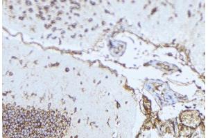 ABIN6276984 at 1/100 staining Mouse brain tissue by IHC-P. (Norrie Disease (Pseudoglioma) anticorps)